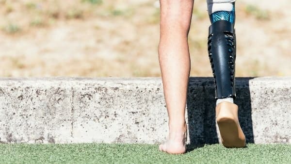 NDIS Exercise Physiologist Sunshine Coast-min NDIS exercise physiologist sunshine coast